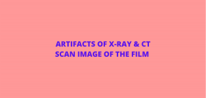 X-RAY & C T SCAN ARTIFACTS IN THE IMAGE