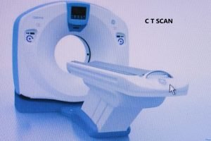 BASIC KNOWLEDGE OF C T SCANNING