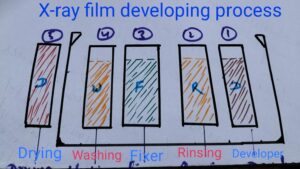 Darkroom procedures in x-ray