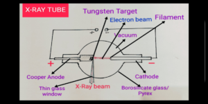 X- RAY DIAGRAM WITH DETAIL